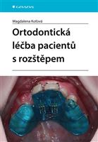 Ortodontická léčba pacientů s rozštěpem